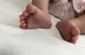 赤ちゃんの足の指6本